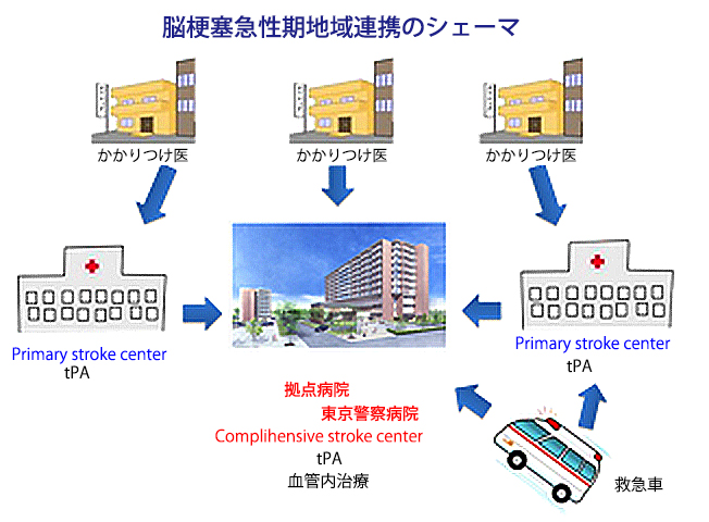 脳梗塞急性期地域連携のシェーマ